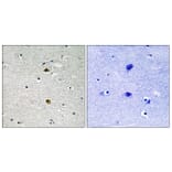 Immunohistochemistry - Anti-NF-kappaB p65 Antibody (B8049) - Antibodies.com