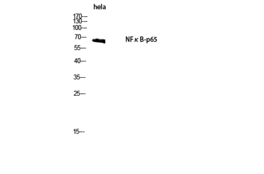 Western Blot - Anti-NF-kappaB p65 Antibody (B8049) - Antibodies.com