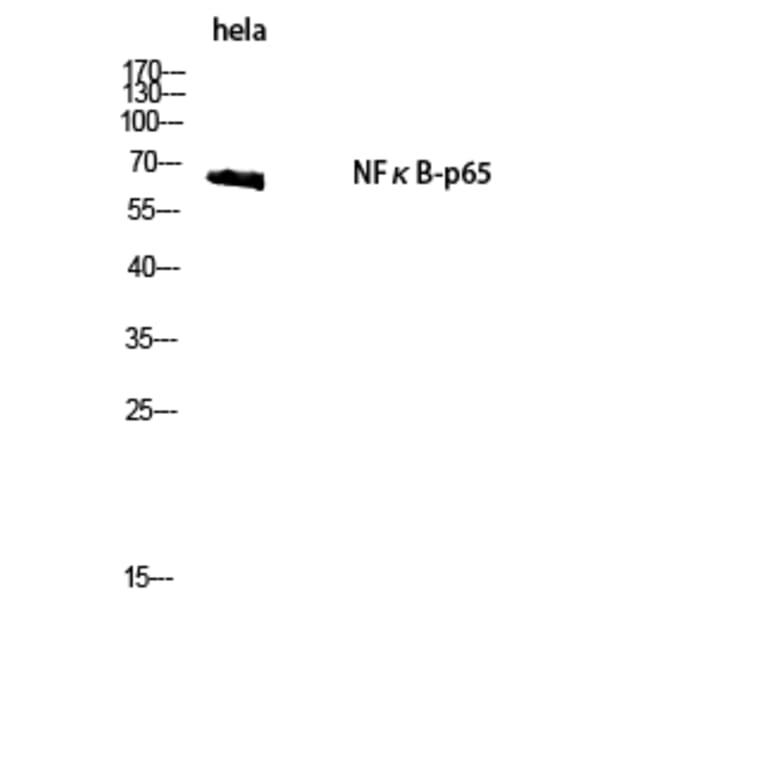 Western Blot - Anti-NF-kappaB p65 Antibody (B8049) - Antibodies.com
