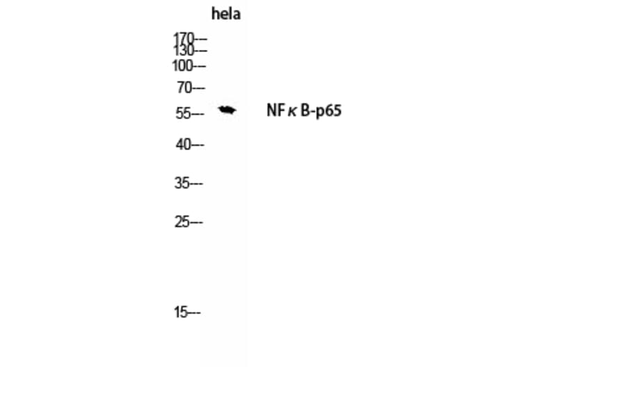 Western Blot - Anti-NF-kappaB p65 Antibody (B8049) - Antibodies.com