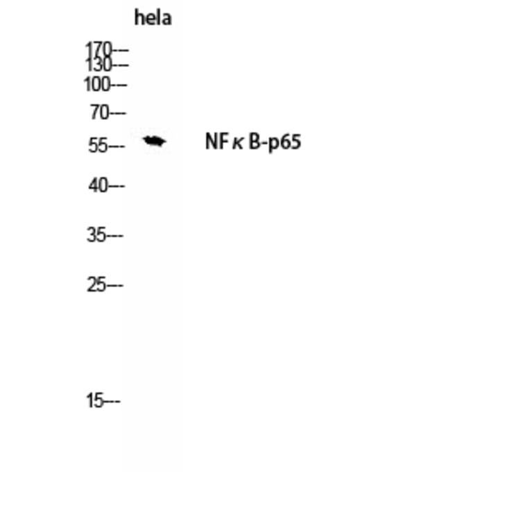 Western Blot - Anti-NF-kappaB p65 Antibody (B8049) - Antibodies.com