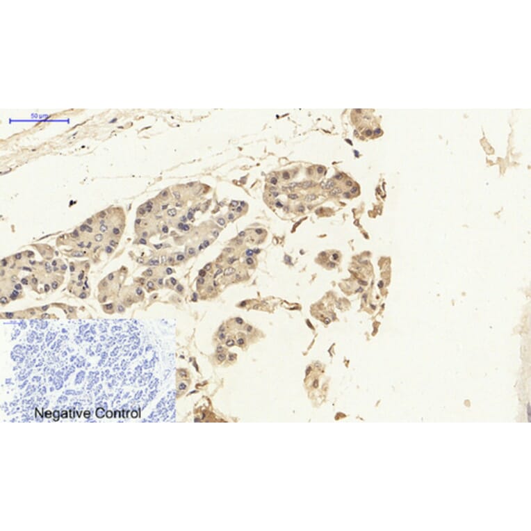 Immunohistochemistry - Anti-NF-kappaB p65 Antibody (B8049) - Antibodies.com