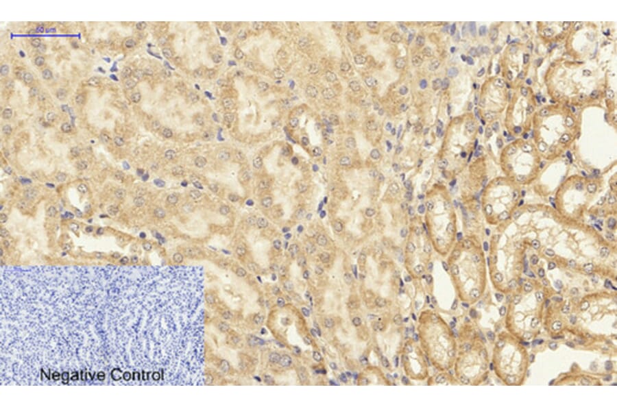 Immunohistochemistry - Anti-NF-kappaB p65 Antibody (B8049) - Antibodies.com