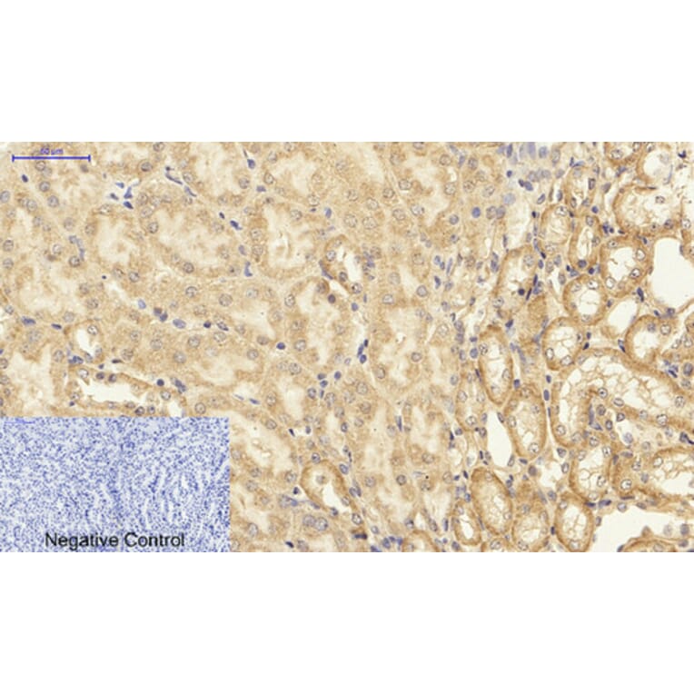 Immunohistochemistry - Anti-NF-kappaB p65 Antibody (B8049) - Antibodies.com