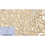 Immunohistochemistry - Anti-NF-kappaB p65 Antibody (B8049) - Antibodies.com