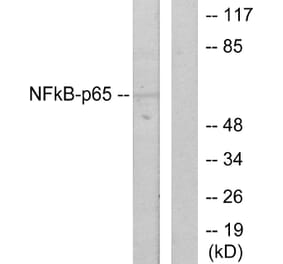 Western Blot - Anti-NF-kappaB p65 Antibody (B7171) - Antibodies.com