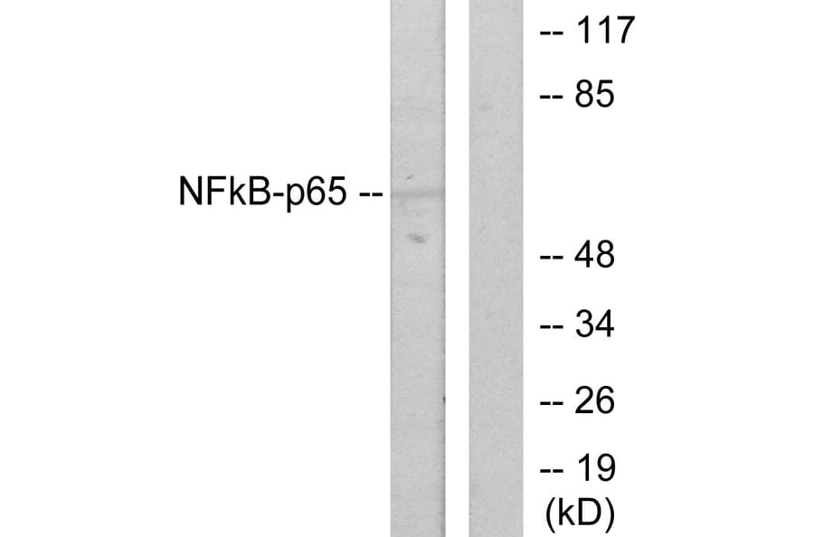 Western Blot - Anti-NF-kappaB p65 Antibody (B7171) - Antibodies.com