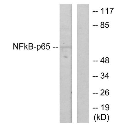 Western Blot - Anti-NF-kappaB p65 Antibody (B7171) - Antibodies.com