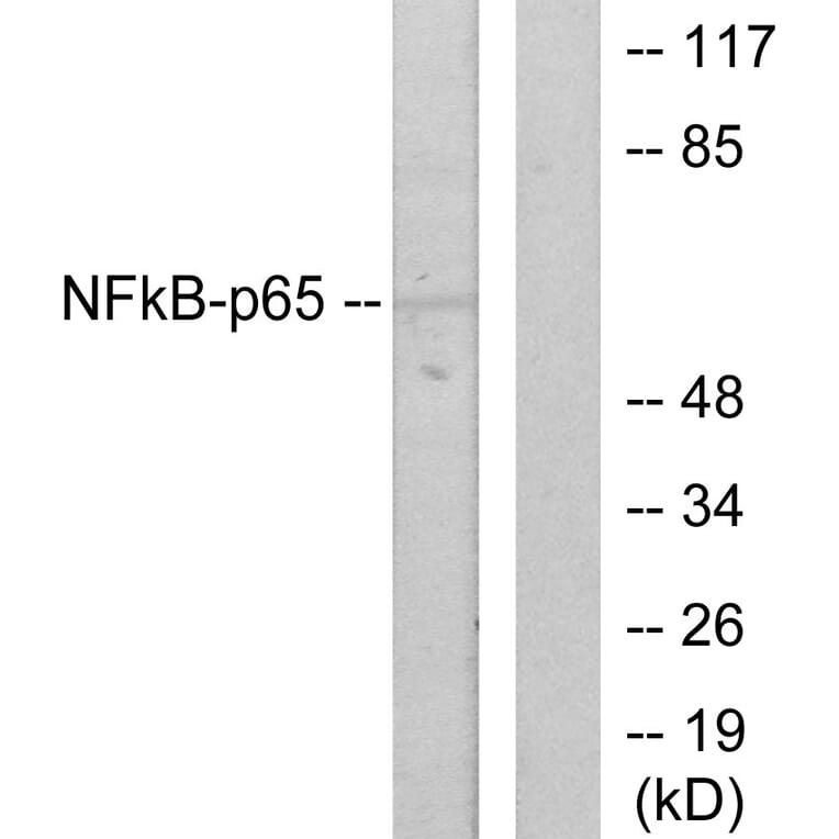 Western Blot - Anti-NF-kappaB p65 Antibody (B7171) - Antibodies.com