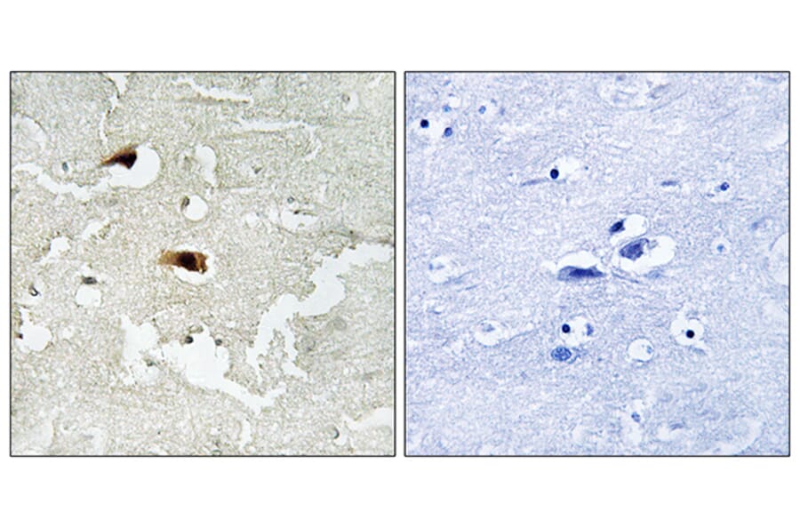 Immunohistochemistry - Anti-NF-kappaB p65 Antibody (B7171) - Antibodies.com