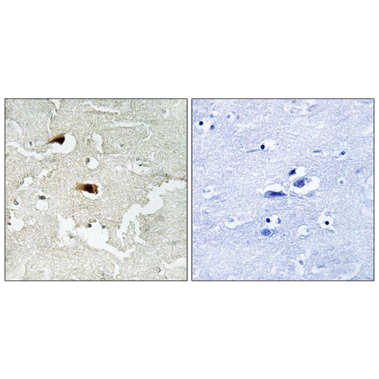 Immunohistochemistry - Anti-NF-kappaB p65 Antibody (B7171) - Antibodies.com