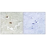 Immunohistochemistry - Anti-NF-kappaB p65 Antibody (B7171) - Antibodies.com