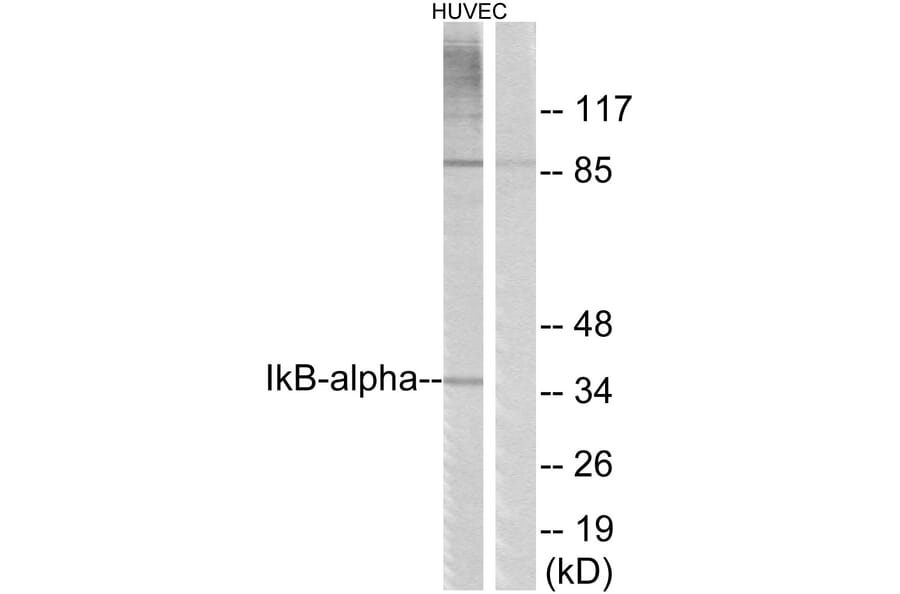 Western Blot - Anti-IkappaB-alpha Antibody (B7116) - Antibodies.com