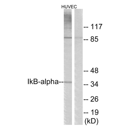 Western Blot - Anti-IkappaB-alpha Antibody (B7116) - Antibodies.com
