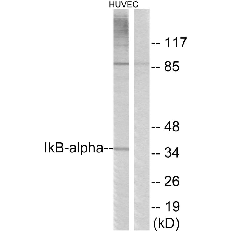 Western Blot - Anti-IkappaB-alpha Antibody (B7116) - Antibodies.com