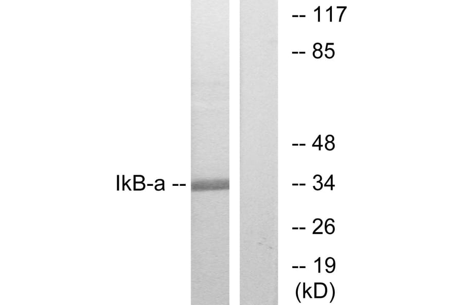 Western Blot - Anti-IkappaB-alpha Antibody (B7124) - Antibodies.com