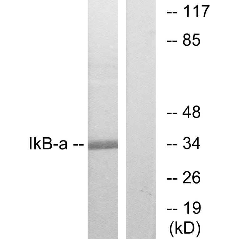 Western Blot - Anti-IkappaB-alpha Antibody (B7124) - Antibodies.com