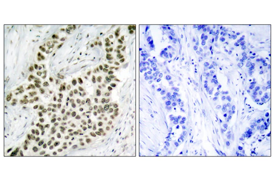 Immunohistochemistry - Anti-Histone H2A.X Antibody (B7106) - Antibodies.com
