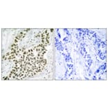 Immunohistochemistry - Anti-Histone H2A.X Antibody (B7106) - Antibodies.com