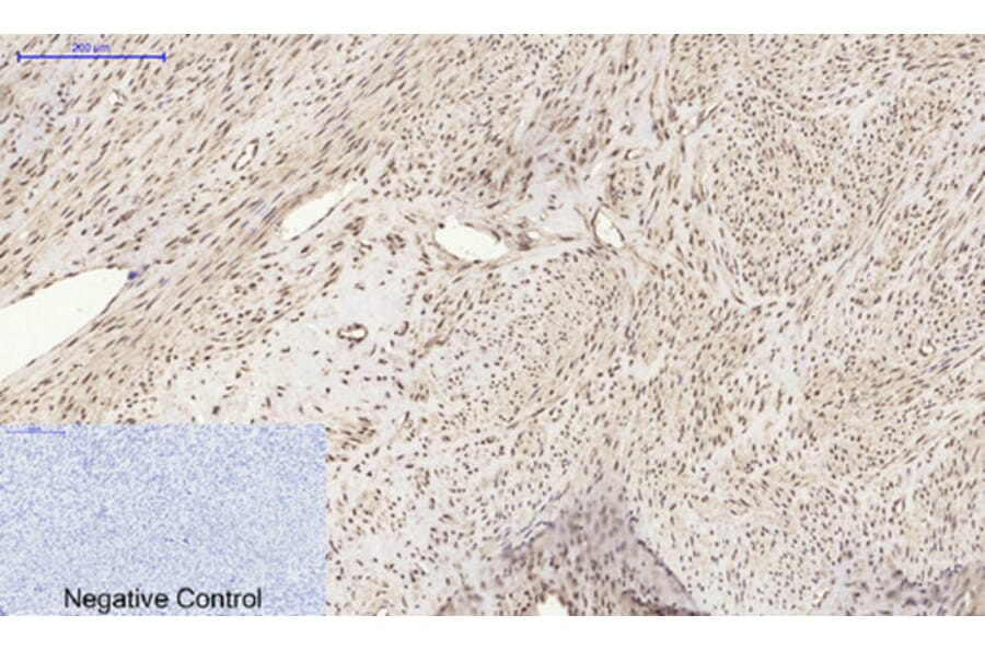 Immunohistochemistry - Anti-Histone H2A.X Antibody (B7106) - Antibodies.com