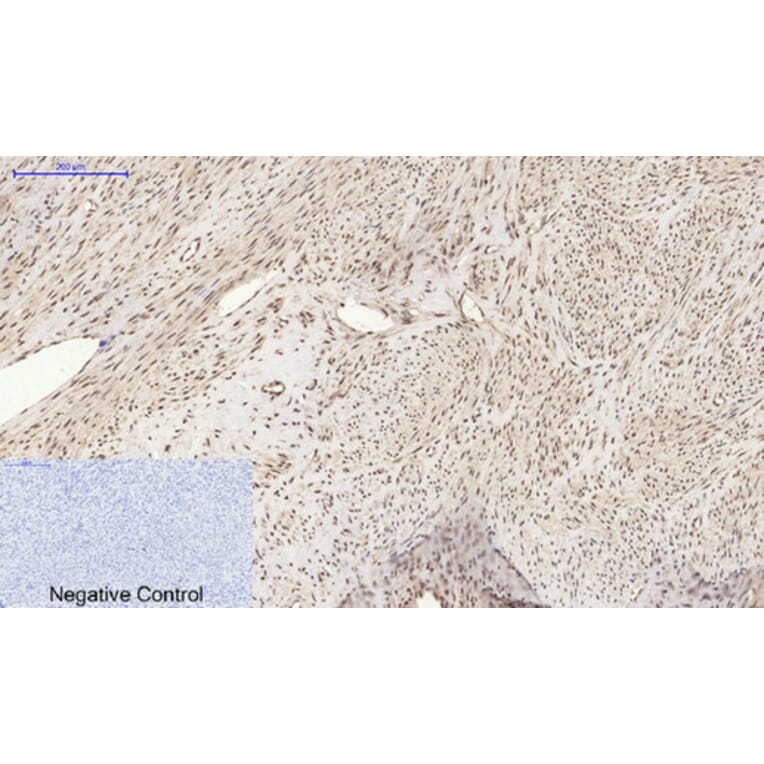 Immunohistochemistry - Anti-Histone H2A.X Antibody (B7106) - Antibodies.com