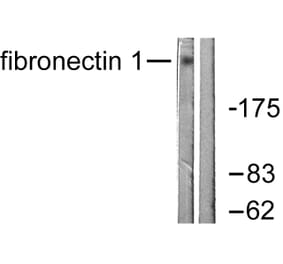 Western Blot - Anti-Fibronectin 1 Antibody (C0195) - Antibodies.com
