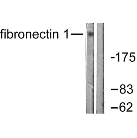 Western Blot - Anti-Fibronectin 1 Antibody (C0195) - Antibodies.com