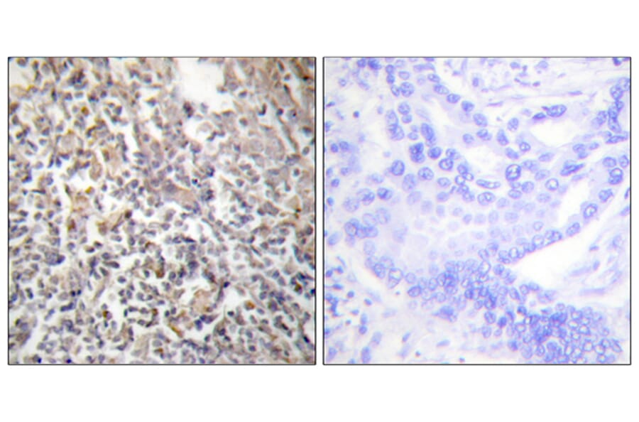 Immunohistochemistry - Anti-Fibronectin 1 Antibody (C0195) - Antibodies.com