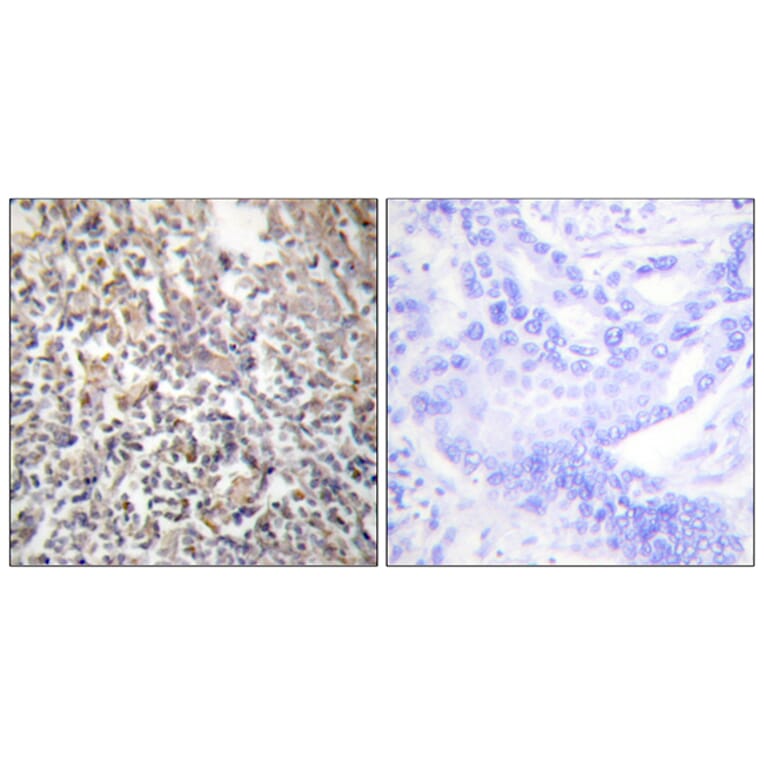 Immunohistochemistry - Anti-Fibronectin 1 Antibody (C0195) - Antibodies.com