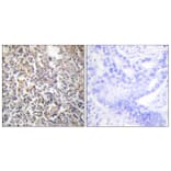 Immunohistochemistry - Anti-Fibronectin 1 Antibody (C0195) - Antibodies.com