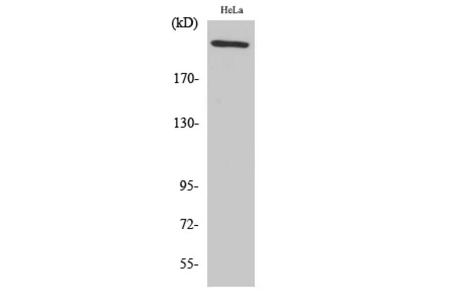 Western Blot - Anti-Fibronectin 1 Antibody (C0195) - Antibodies.com