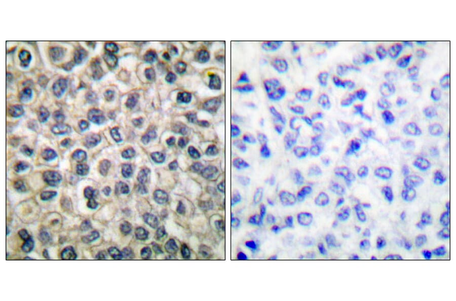 Immunohistochemistry - Anti-Catenin-gamma Antibody (C0138) - Antibodies.com