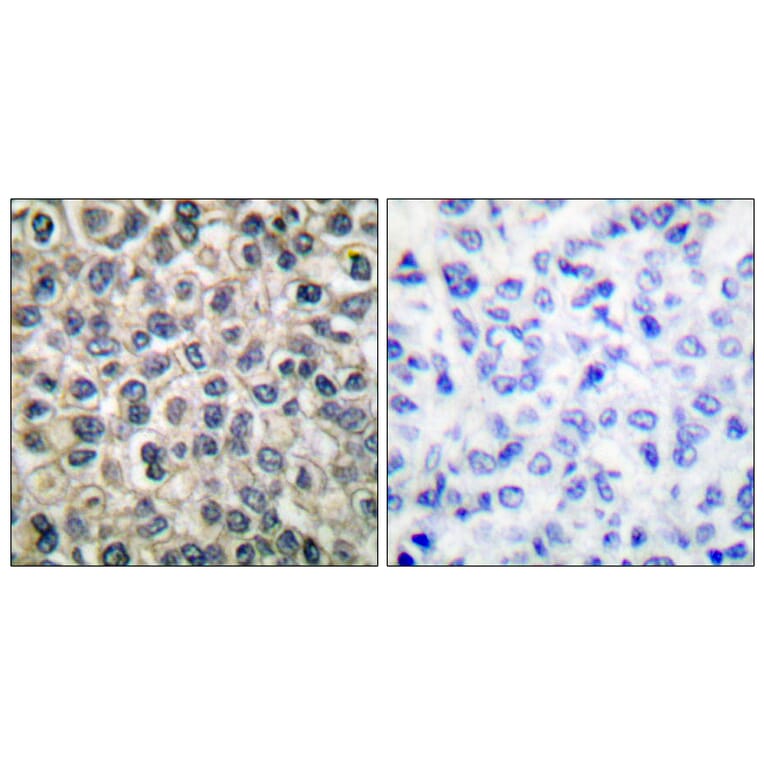 Immunohistochemistry - Anti-Catenin-gamma Antibody (C0138) - Antibodies.com