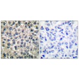 Immunohistochemistry - Anti-Catenin-gamma Antibody (C0138) - Antibodies.com