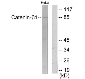 Western Blot - Anti-Catenin-beta1 Antibody (C10546) - Antibodies.com