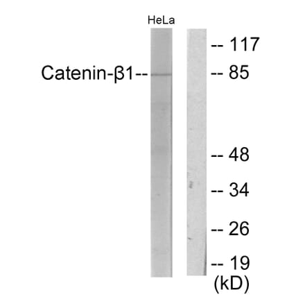 Western Blot - Anti-Catenin-beta1 Antibody (C10546) - Antibodies.com