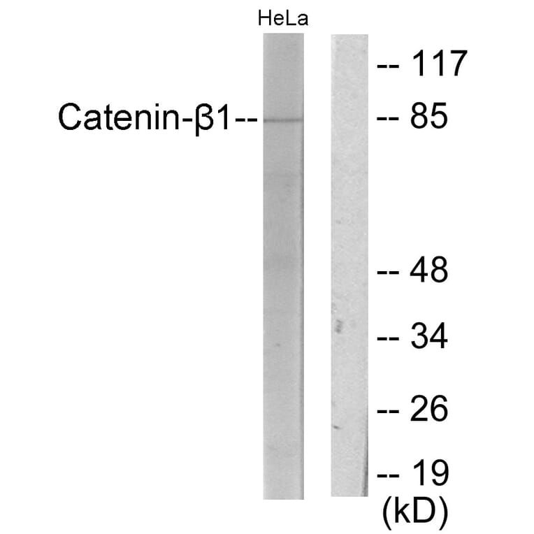 Western Blot - Anti-Catenin-beta1 Antibody (C10546) - Antibodies.com