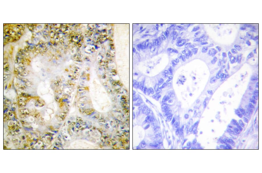 Immunohistochemistry - Anti-Catenin-beta1 Antibody (C10546) - Antibodies.com
