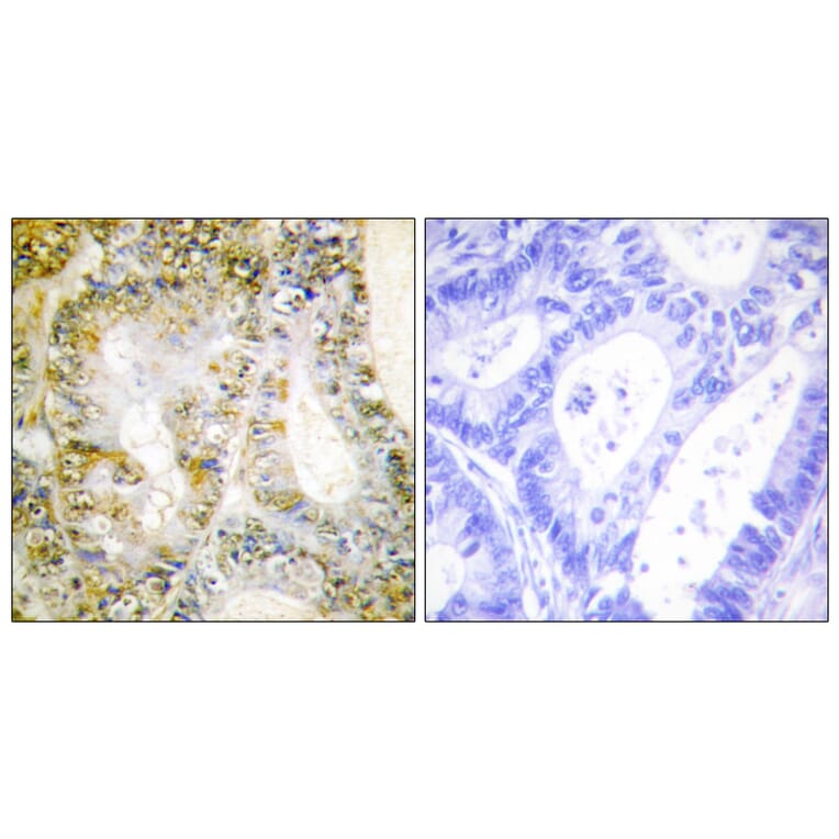 Immunohistochemistry - Anti-Catenin-beta1 Antibody (C10546) - Antibodies.com