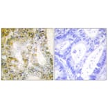 Immunohistochemistry - Anti-Catenin-beta1 Antibody (C10546) - Antibodies.com