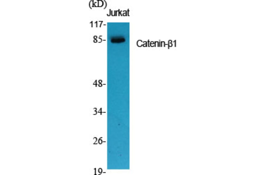 Western Blot - Anti-Catenin-beta1 Antibody (C10546) - Antibodies.com