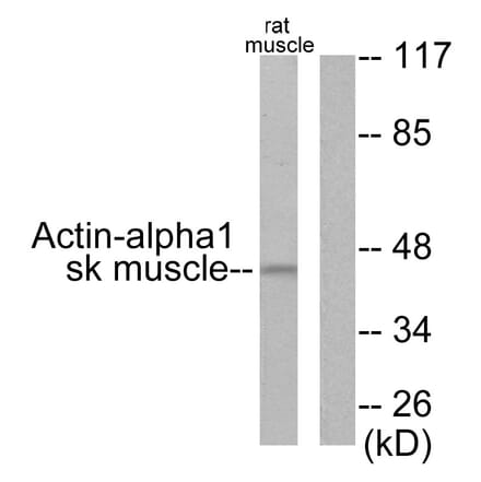 Western Blot - Anti-Actin-alpha-1 Antibody (C0121) - Antibodies.com