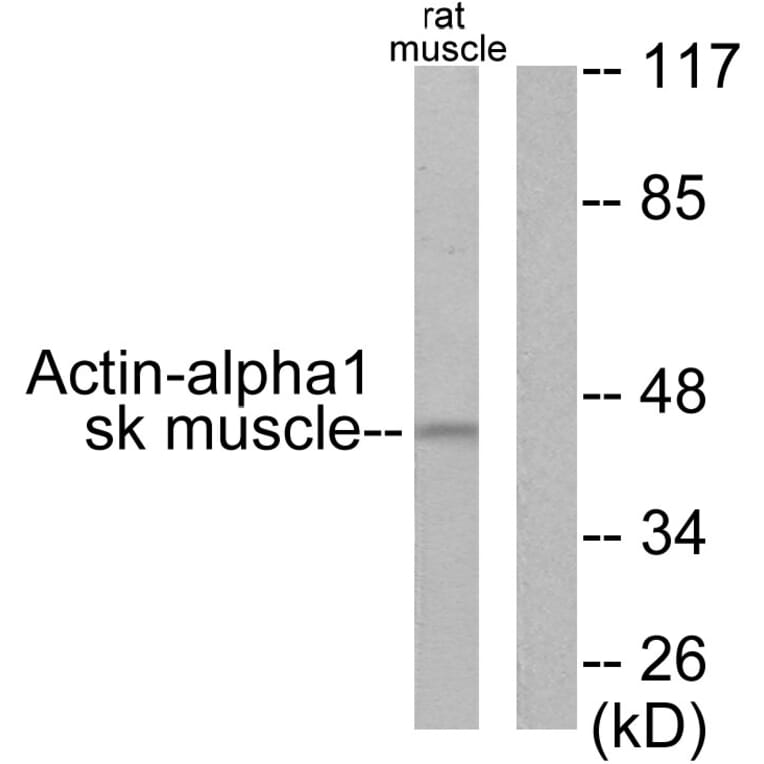 Western Blot - Anti-Actin-alpha-1 Antibody (C0121) - Antibodies.com