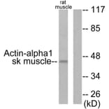 Western Blot - Anti-Actin-alpha-1 Antibody (C0121) - Antibodies.com