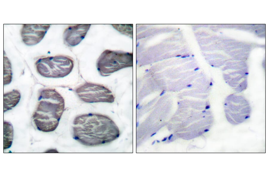 Immunohistochemistry - Anti-Actin-alpha-1 Antibody (C0121) - Antibodies.com