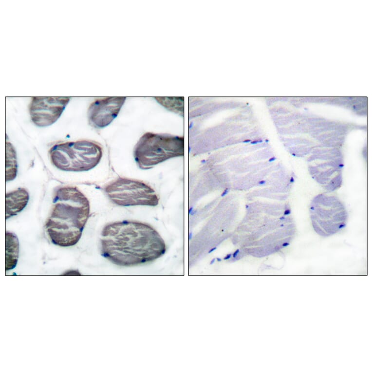 Immunohistochemistry - Anti-Actin-alpha-1 Antibody (C0121) - Antibodies.com