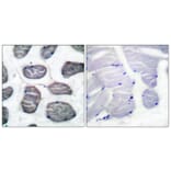 Immunohistochemistry - Anti-Actin-alpha-1 Antibody (C0121) - Antibodies.com