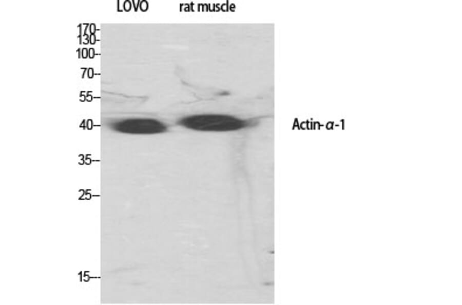 Western Blot - Anti-Actin-alpha-1 Antibody (C0121) - Antibodies.com