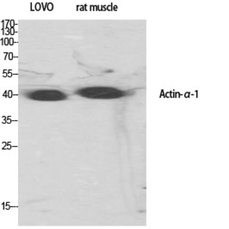 Western Blot - Anti-Actin-alpha-1 Antibody (C0121) - Antibodies.com