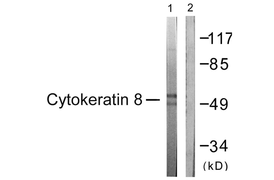 Western Blot - Anti-Keratin 8 Antibody (B0883) - Antibodies.com